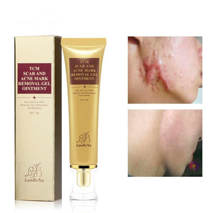 ACNE SCAR REMOVAL CREAM