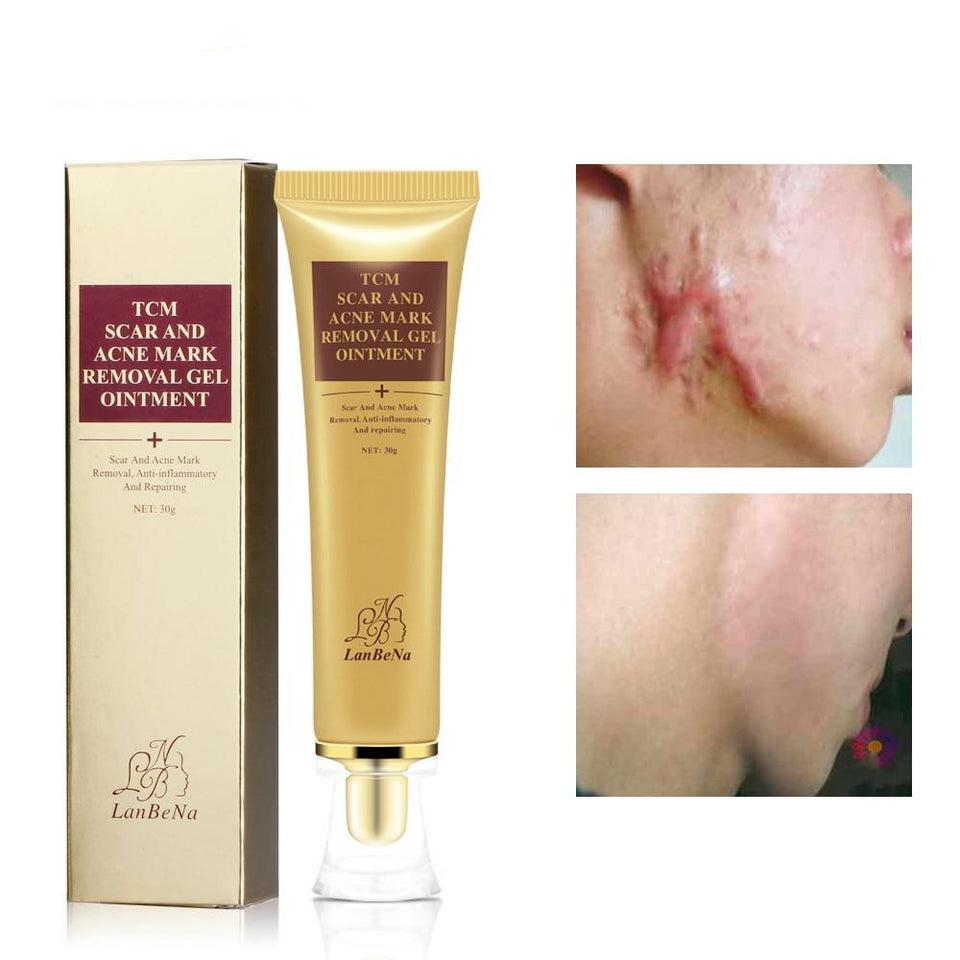 ACNE SCAR REMOVAL CREAM