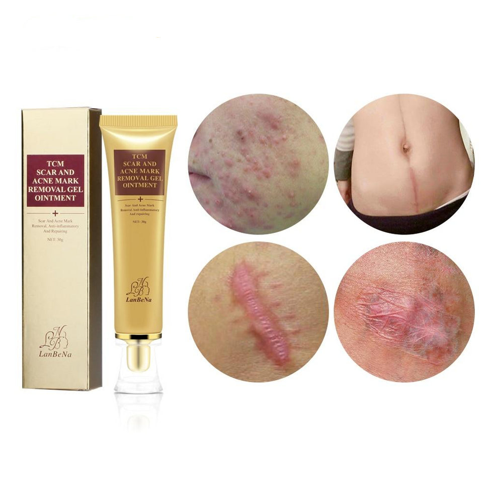 ACNE SCAR REMOVAL CREAM